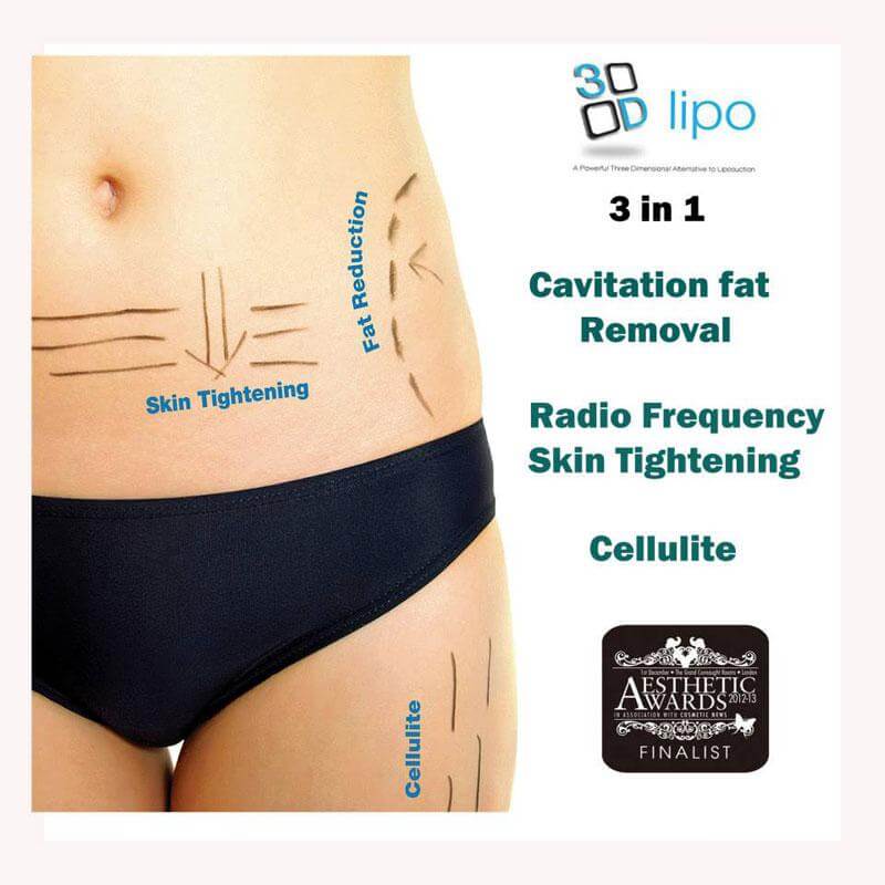 3D lipo Cavitation