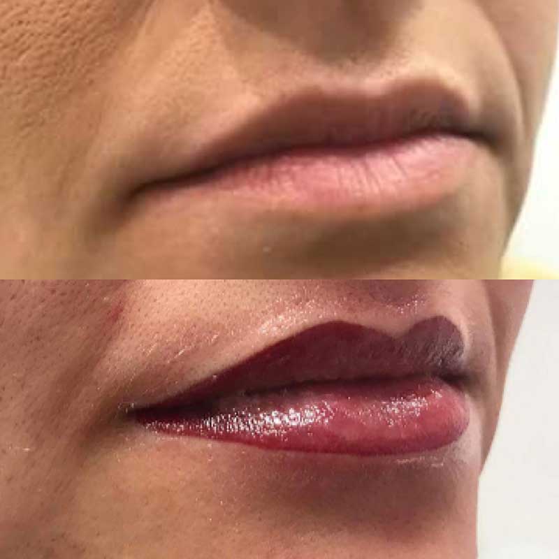 Semi Permanent Lips