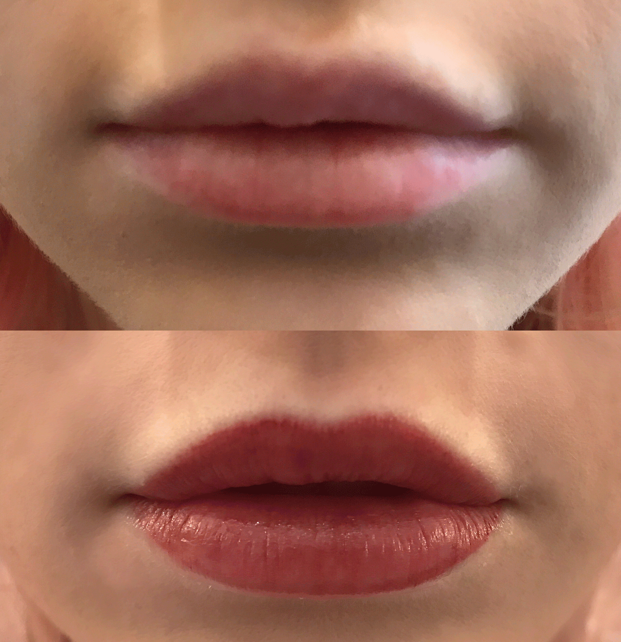 Semi Permanent Lips