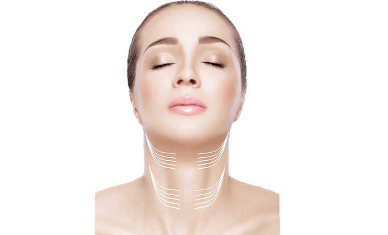 Thread Neck Lift