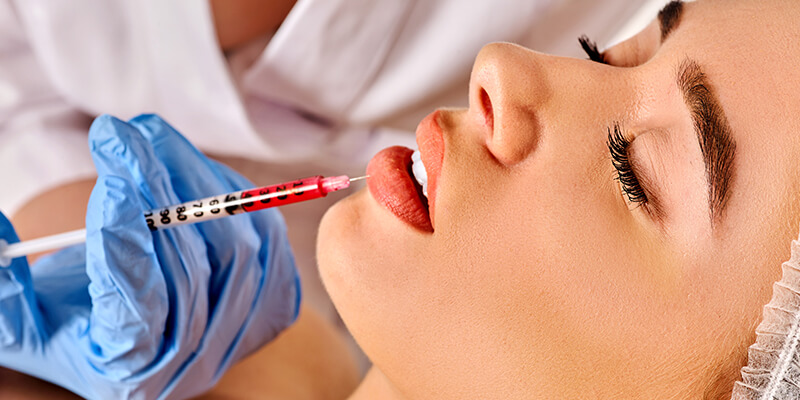 dermal fillers