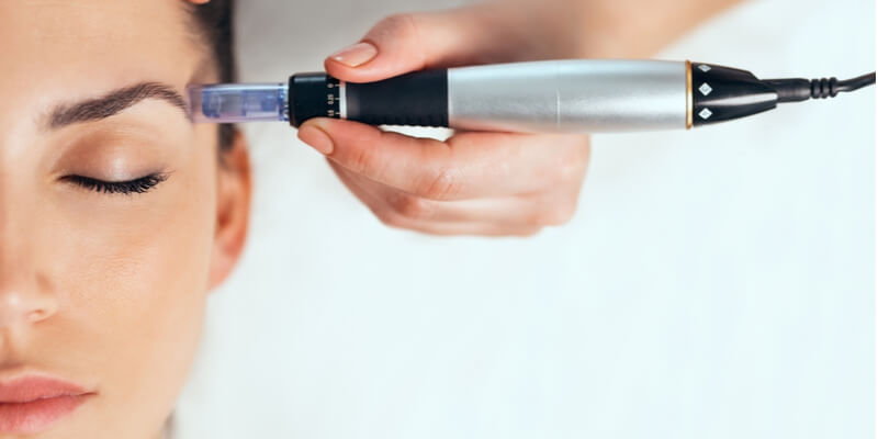 Dermapen® microneedling treatment