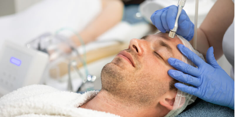 microdermabrasion