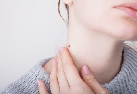 woman looking at her mole on her neck