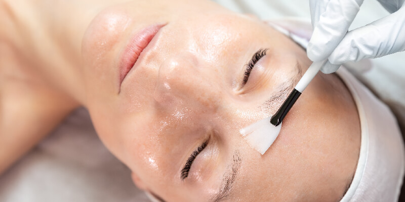 Skin Peel Treatment